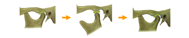 正常顎関節の図